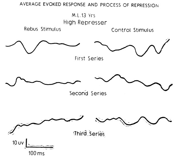 Figure 7. The above subject, M. L., a high represser, illustrates the initially high average evoked response to the experimental subliminal stimulus and its gradual disappearance across the series. By contrast the control stimulus shows no such diminution, thus illustrating that unconscious processes are sensitive to meaningfulness